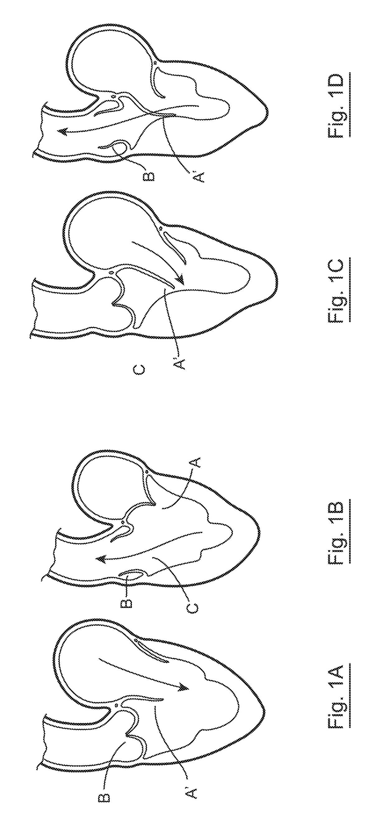 Implantable intracardiac device and methods thereof