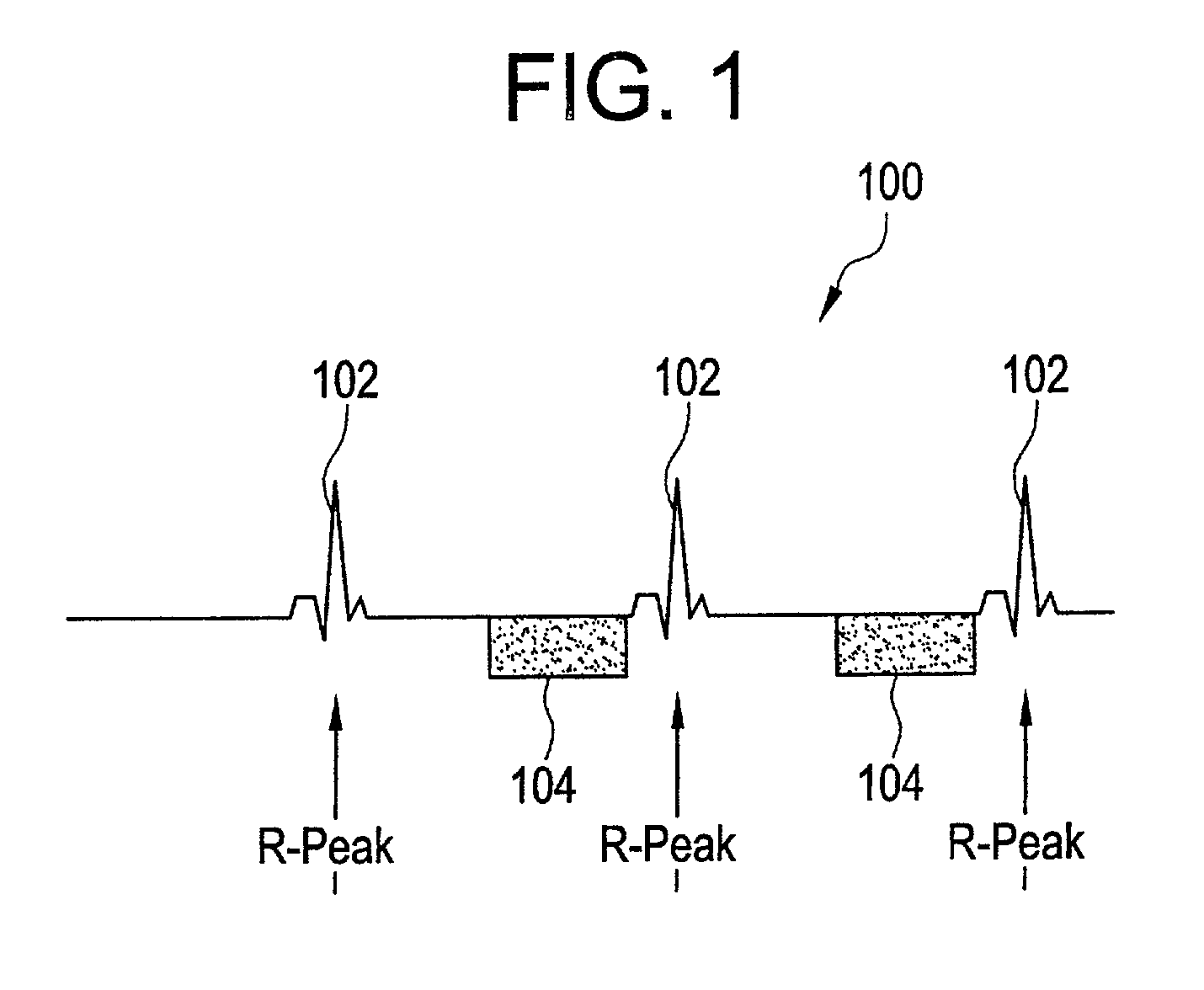 Method and system for associating an EKG waveform with a CT image
