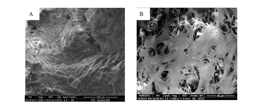 Beta-dicalcium silicate porous biological ceramic bracket and preparation method and application thereof
