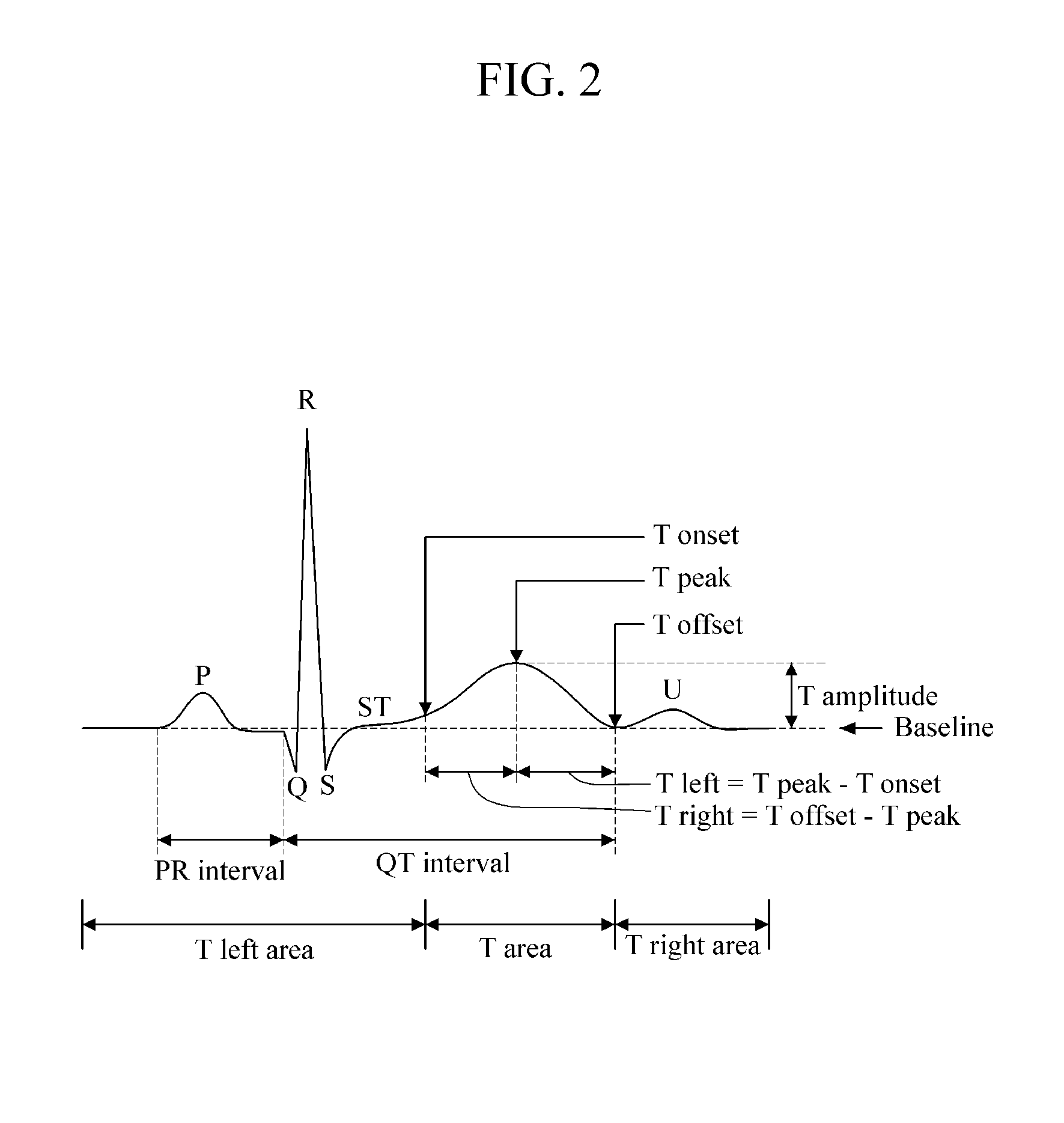 Apparatus and method for generating atrial fibrillation prediction model, and apparatus and method for predicting atrial fibrillation