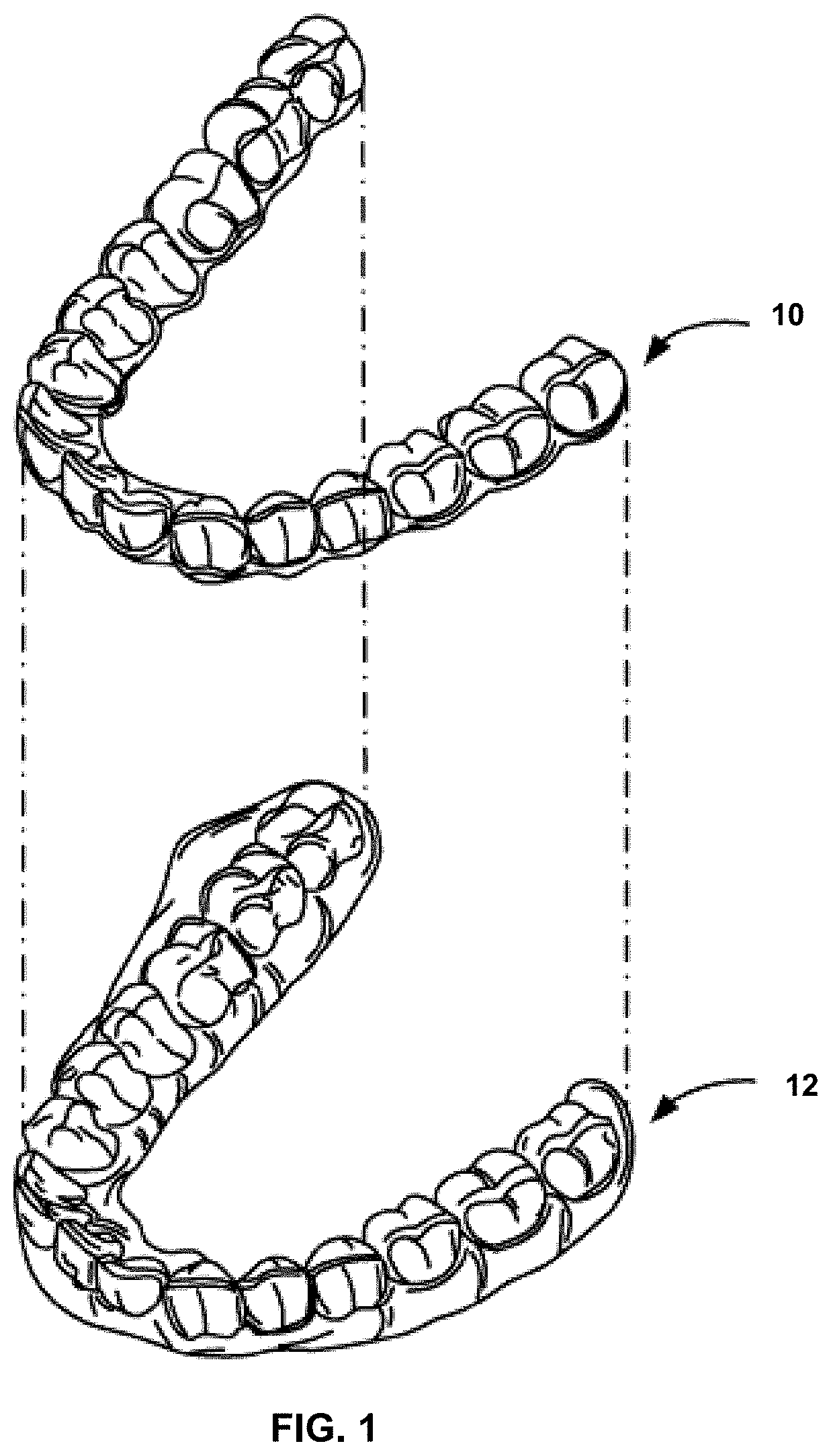 Elastically modifiable orthodontic appliances