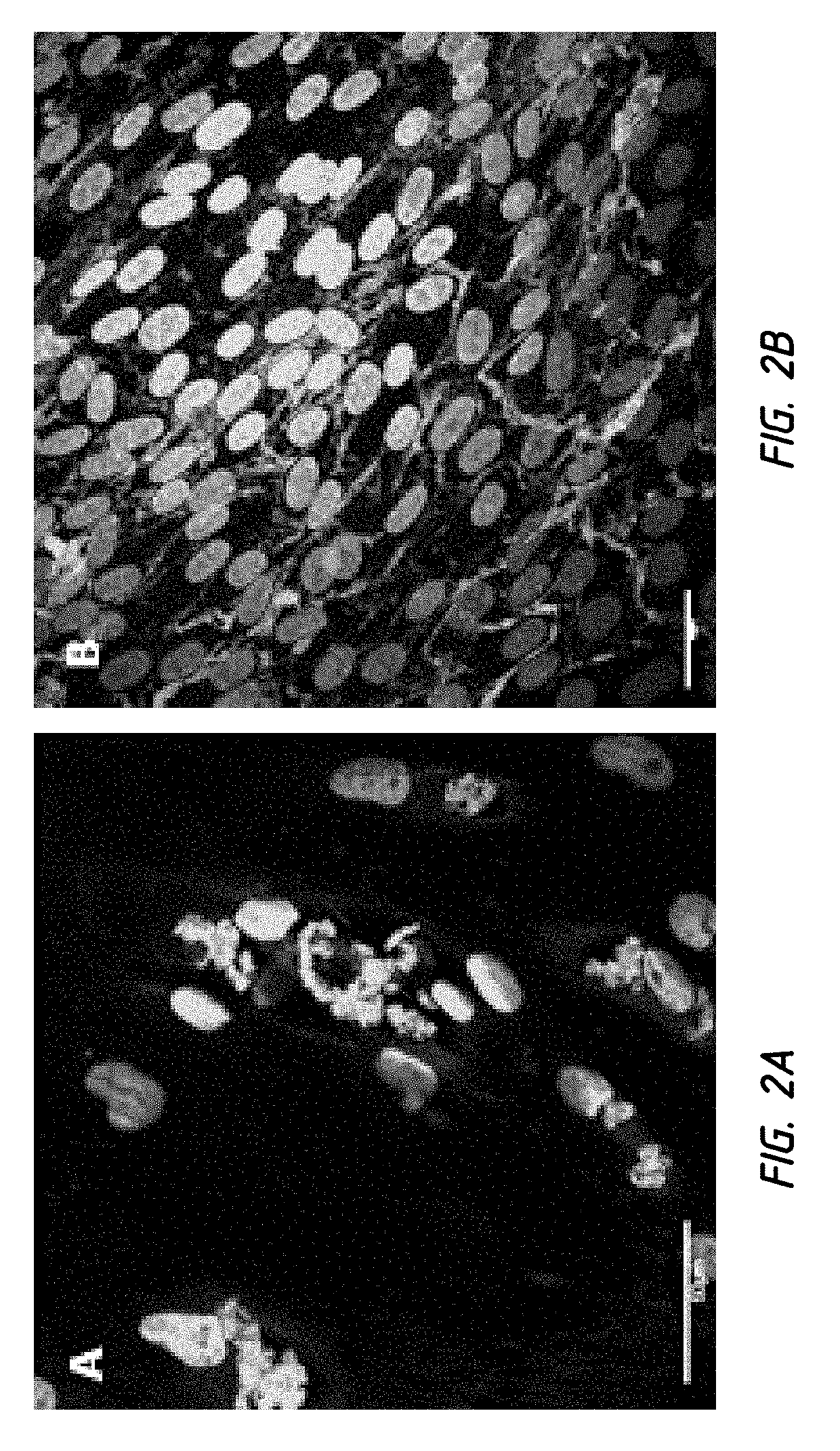 In vivo synthesis of elastic fiber