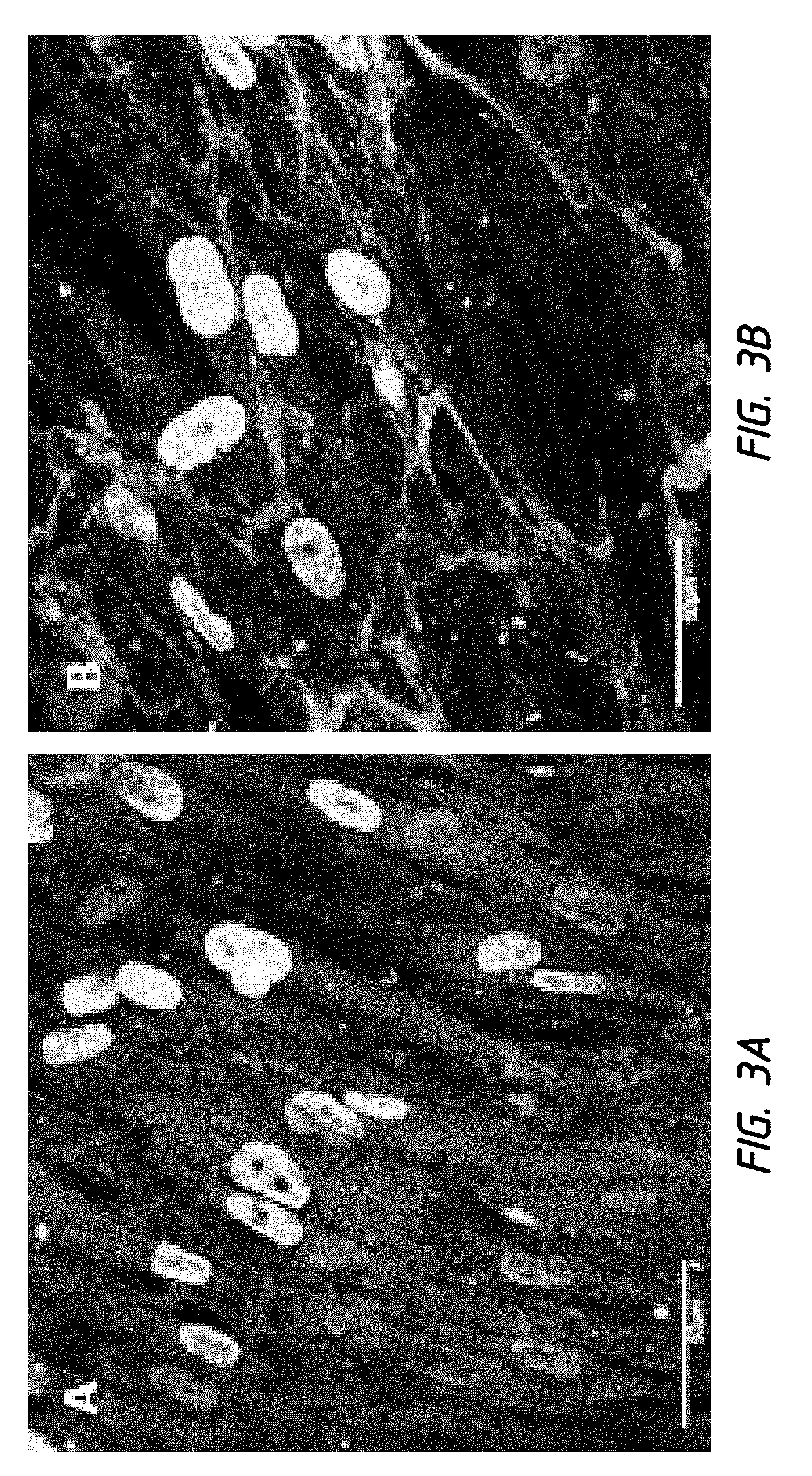 In vivo synthesis of elastic fiber