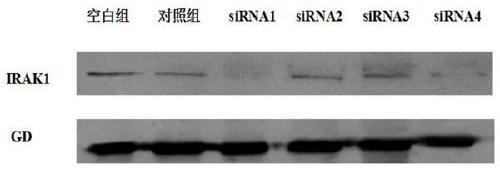 Small interfering RNA targeting human irak1 gene and its application