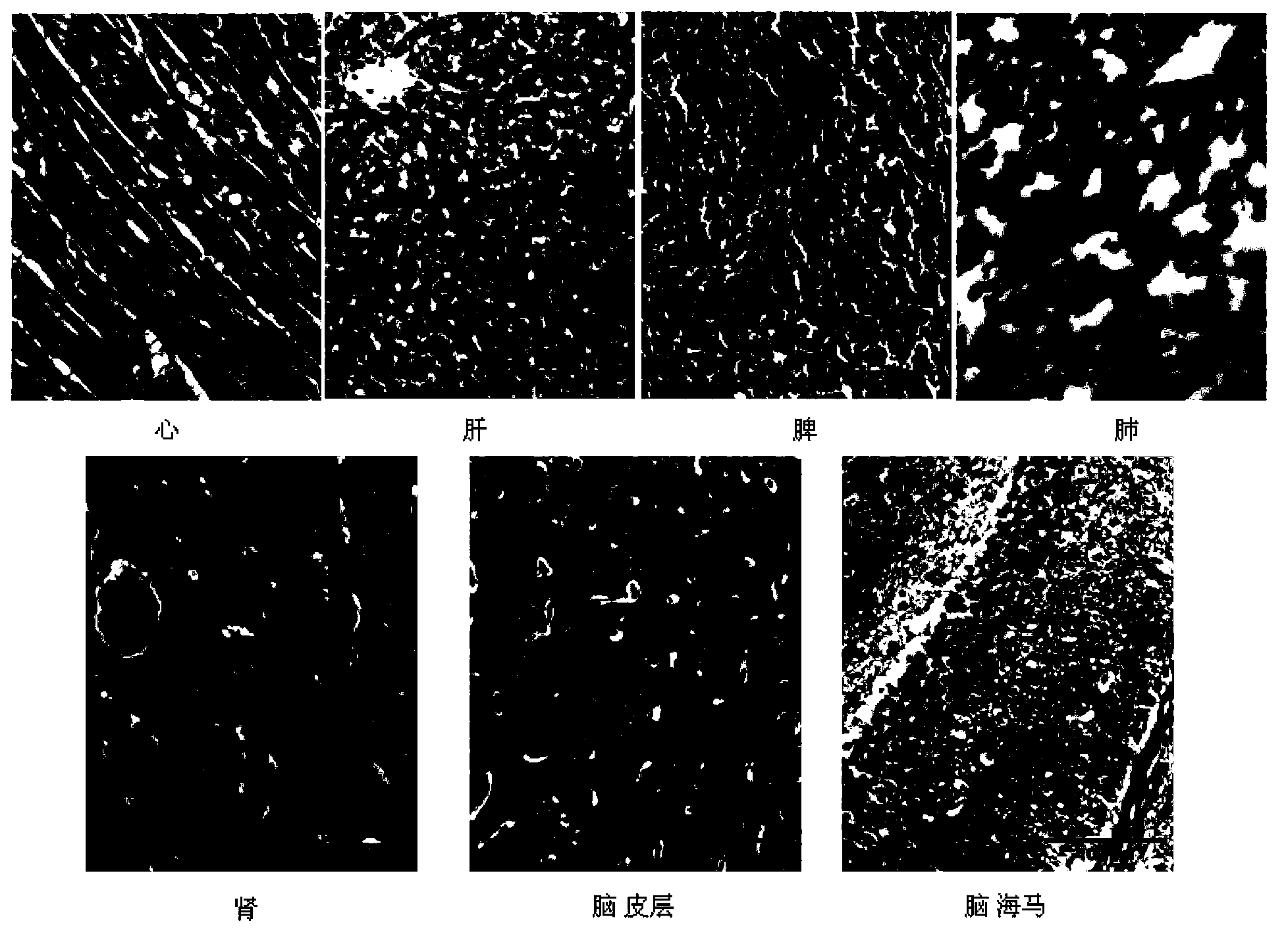 Target nano lipid core micelle used for carrying docetaxel, and preparation method and applications thereof