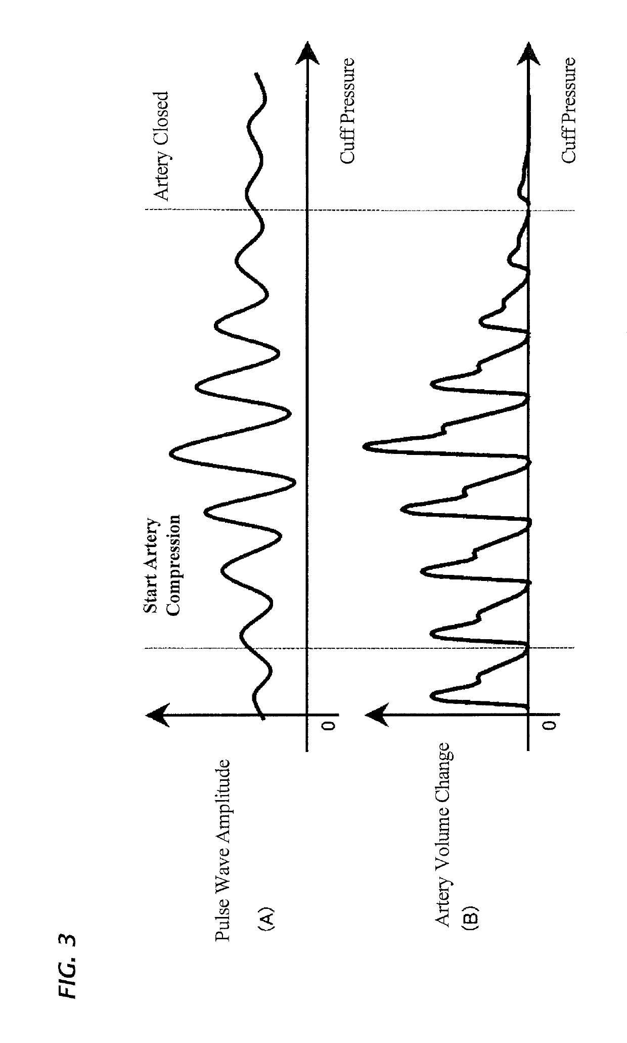 Electronic sphygmomanometer for measuring blood pressure and pulse