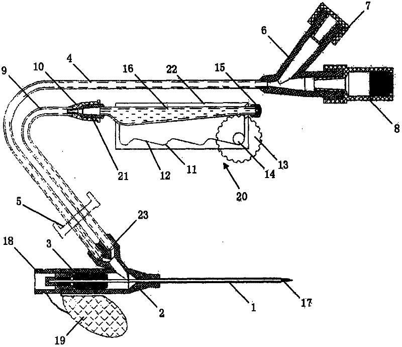 Venous retention needle suite with hirudin anticoagulation tube sealing device