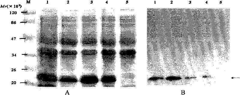 Epitope of Epstein-Barr virus latent membrane protein 2b and its application