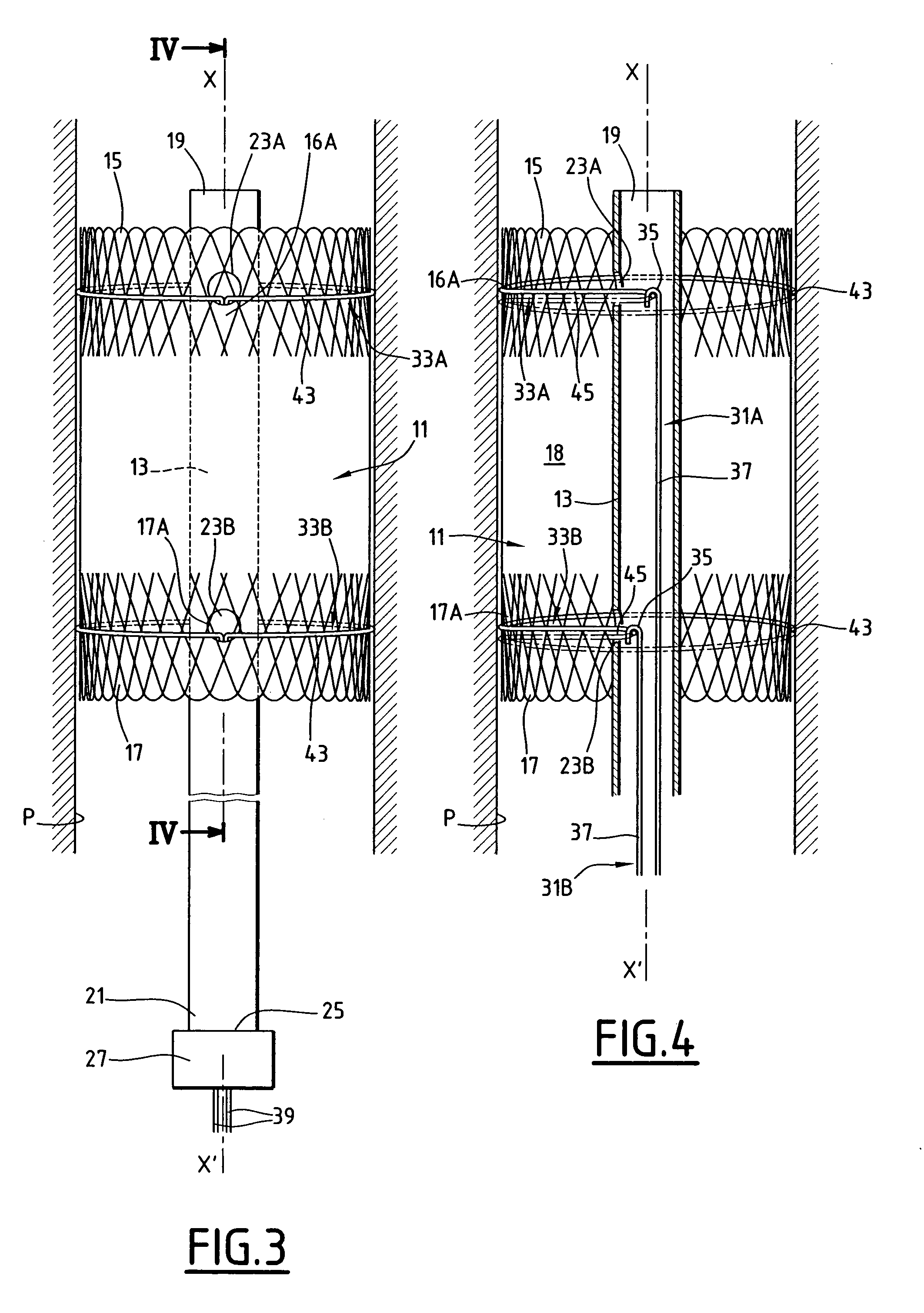 Device for treating a blood circulation canal and process for preparing this device