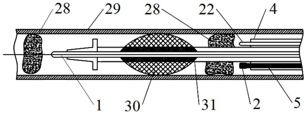 Intelligent device with laser thrombus crushing function