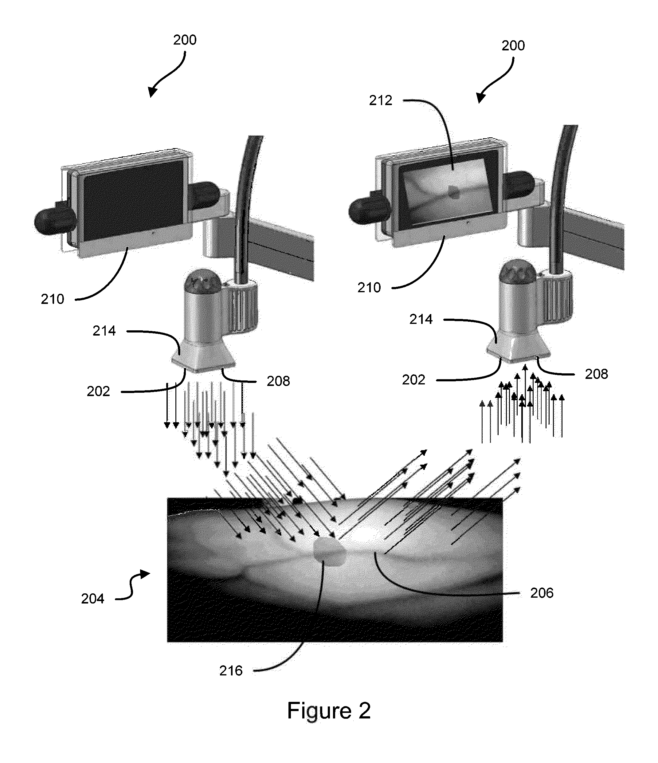 Vein imaging systems and methods