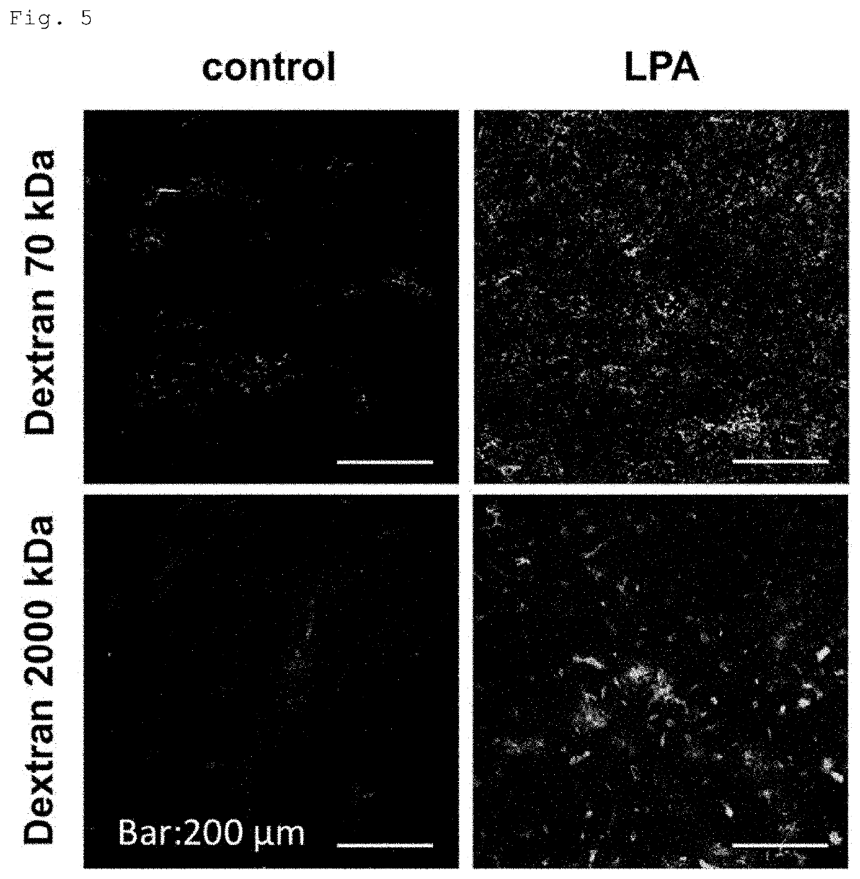 Drug delivery enhancer comprising substance for activating lysophospholipid receptors