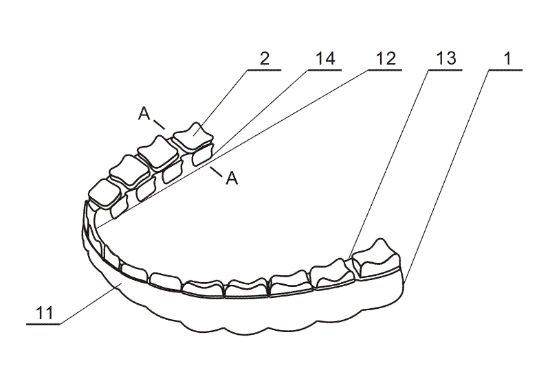 Tooth socket for protecting teeth