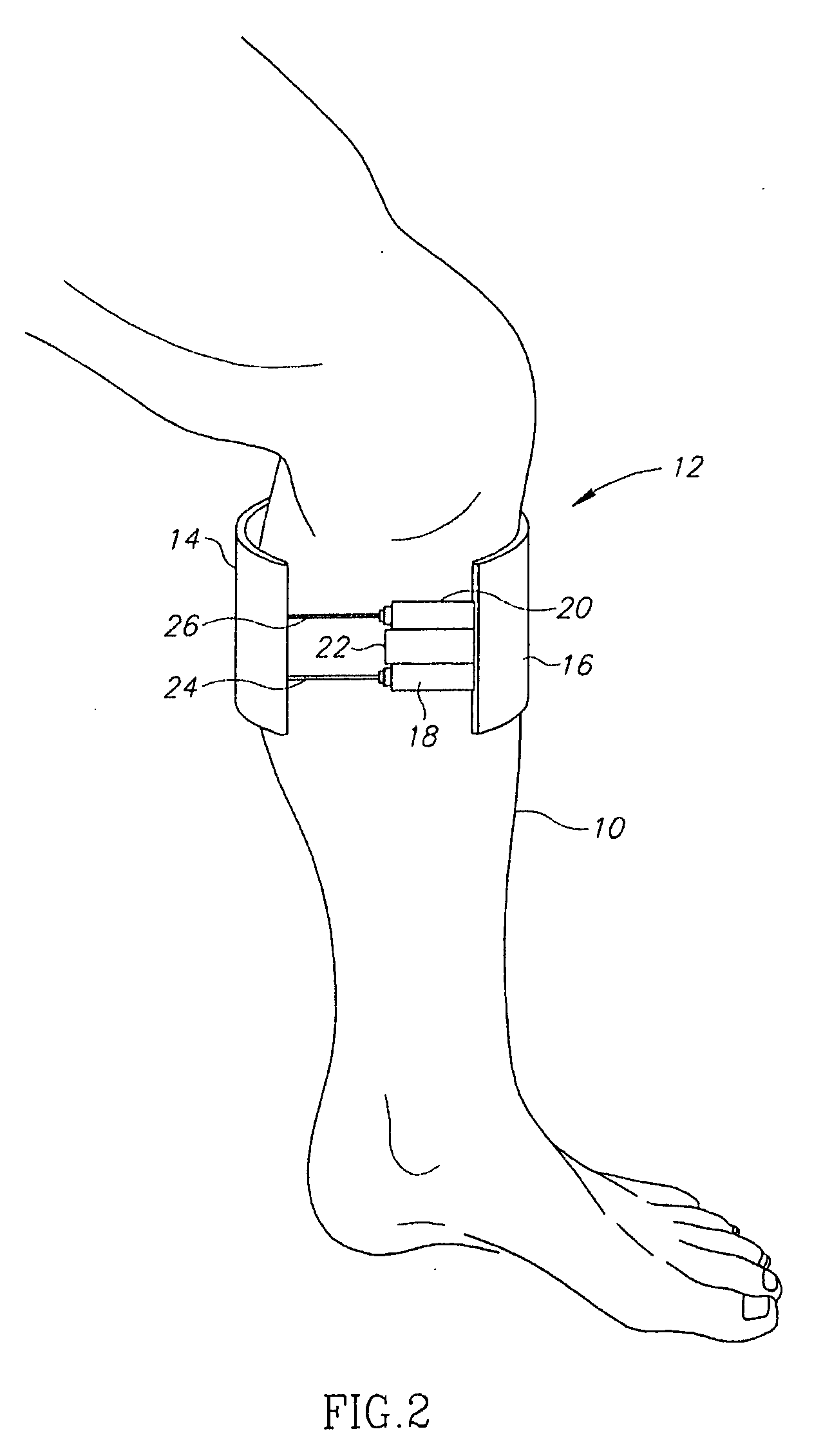 Portable device for the enhancement of circulation