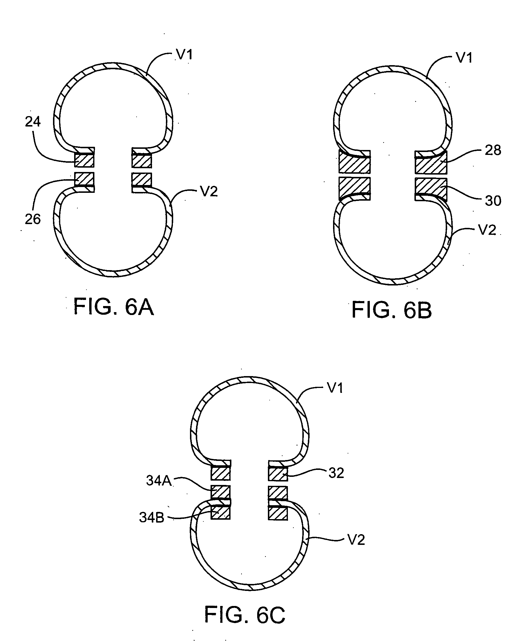 Extravascular anastomotic components and methods for forming magnetic anastomoses