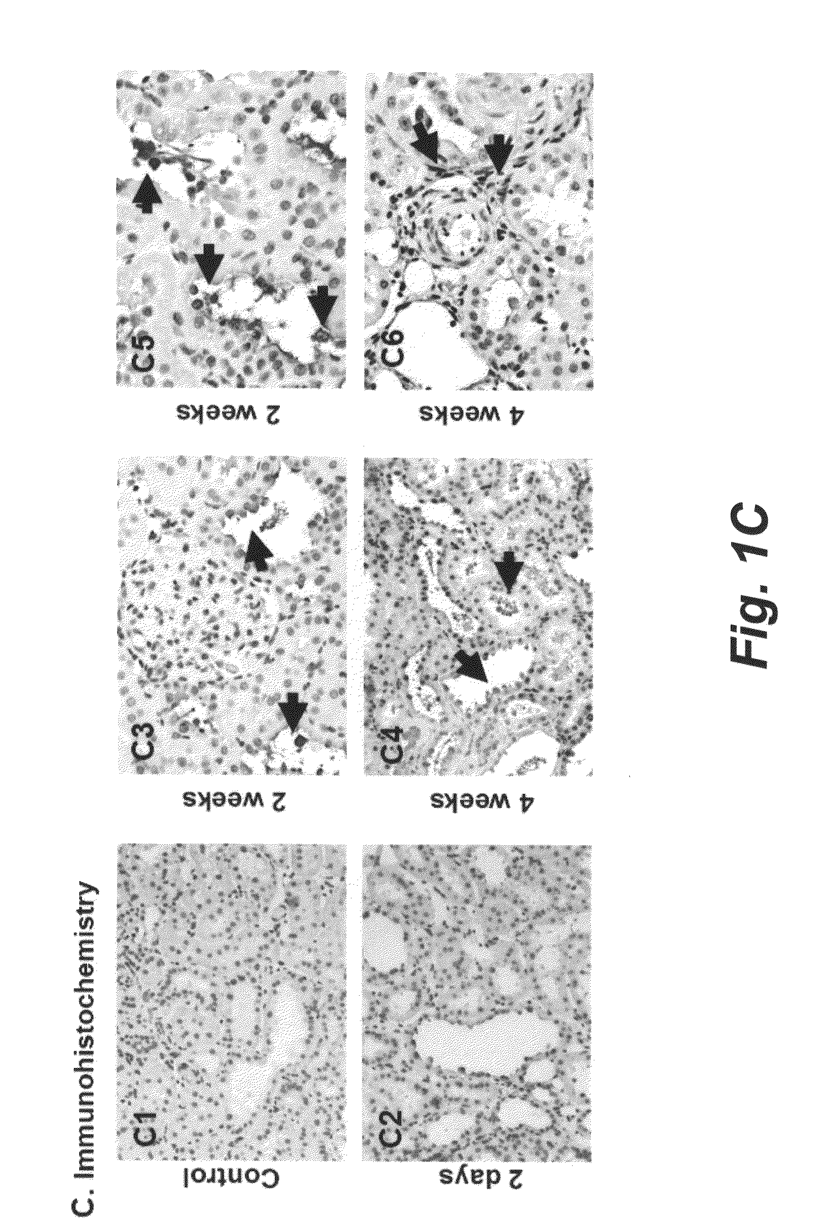 Use of periostin as a novel biomarker