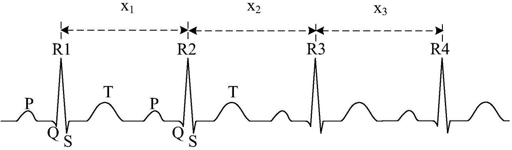 Electrocardiogram-based heart rate analysis method and equipment