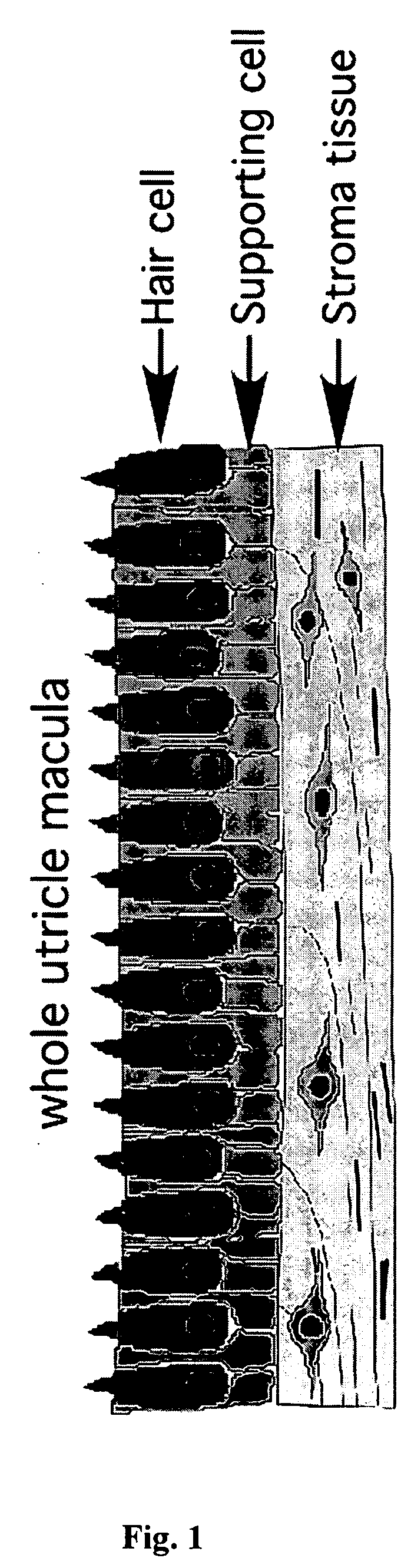 Methods and products related to the production of inner ear hair cells