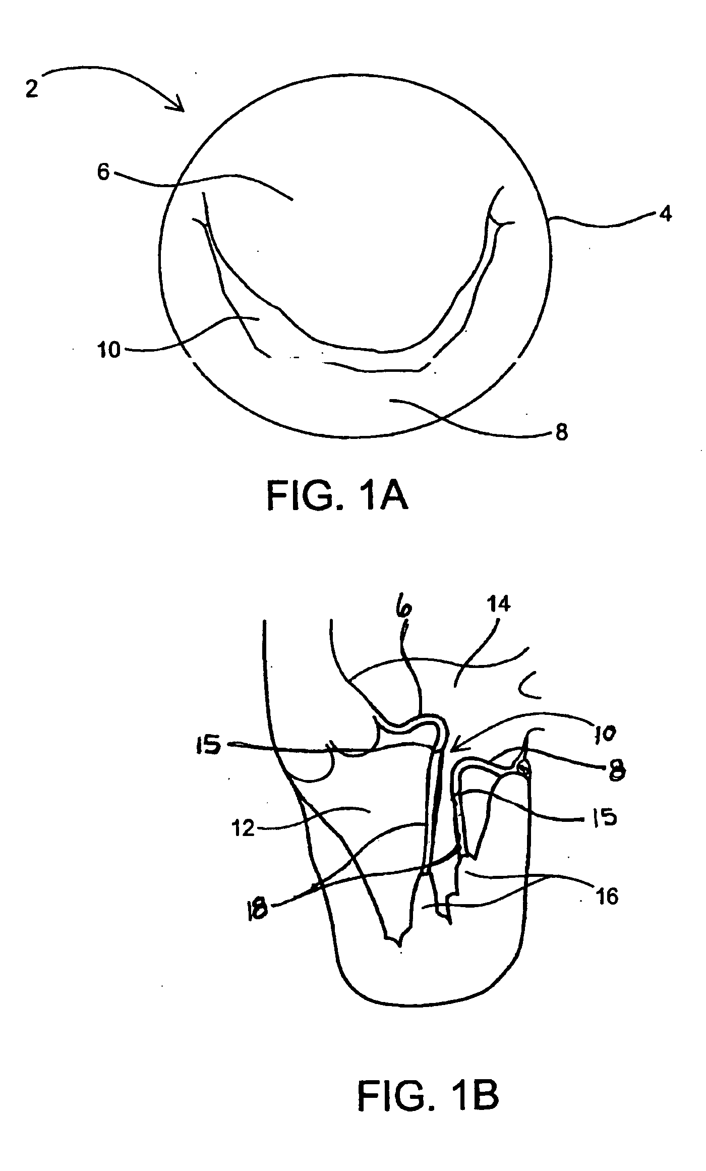 Devices and methods of repairing cardiac valves