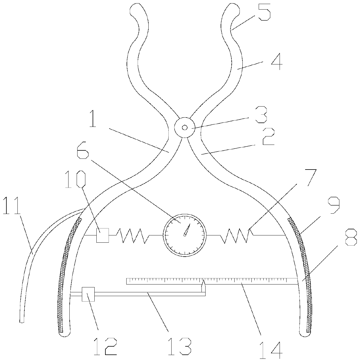 Artificial anus expansion forceps and method of use thereof