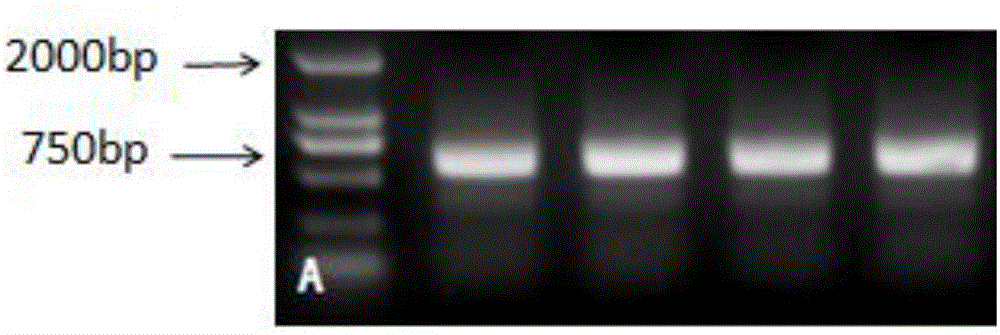 Soybean phosphorus starvation transcription factor GmWRKY75, encoded protein and application of phosphorus starvation transcription factor GmWRKY75