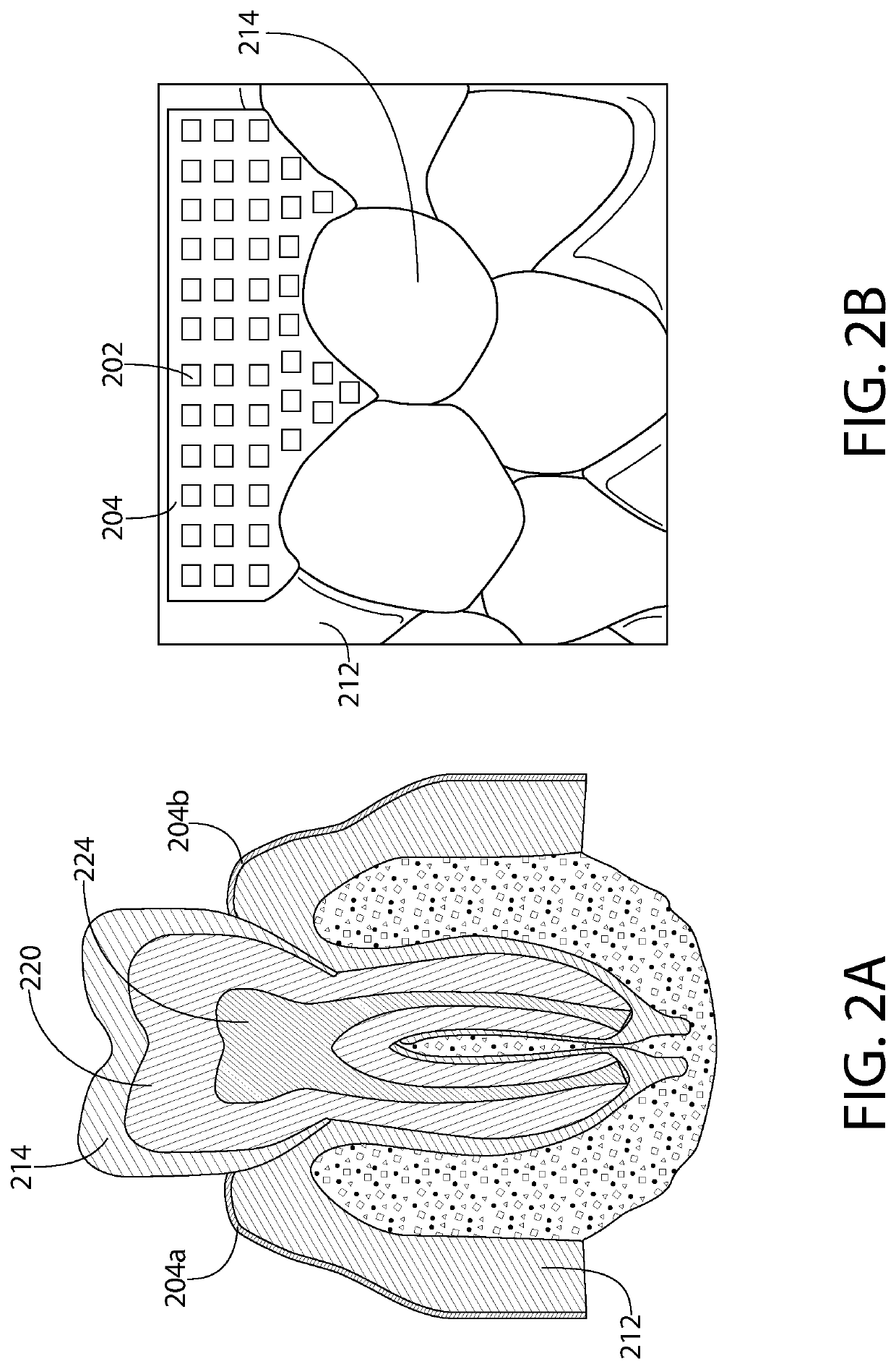 System and Method for Oral Health Monitoring Using Electrical Impedance Tomography