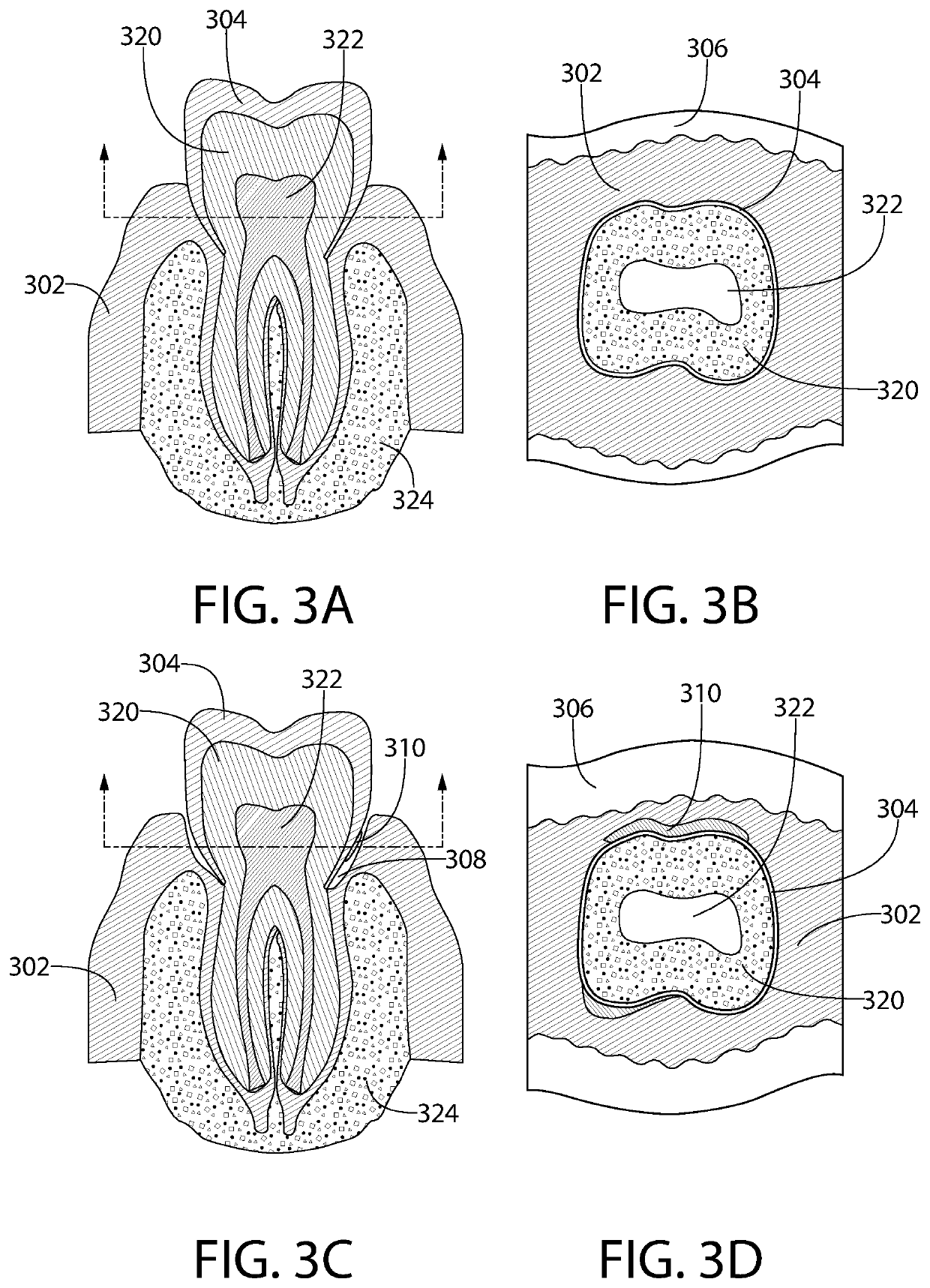 System and Method for Oral Health Monitoring Using Electrical Impedance Tomography