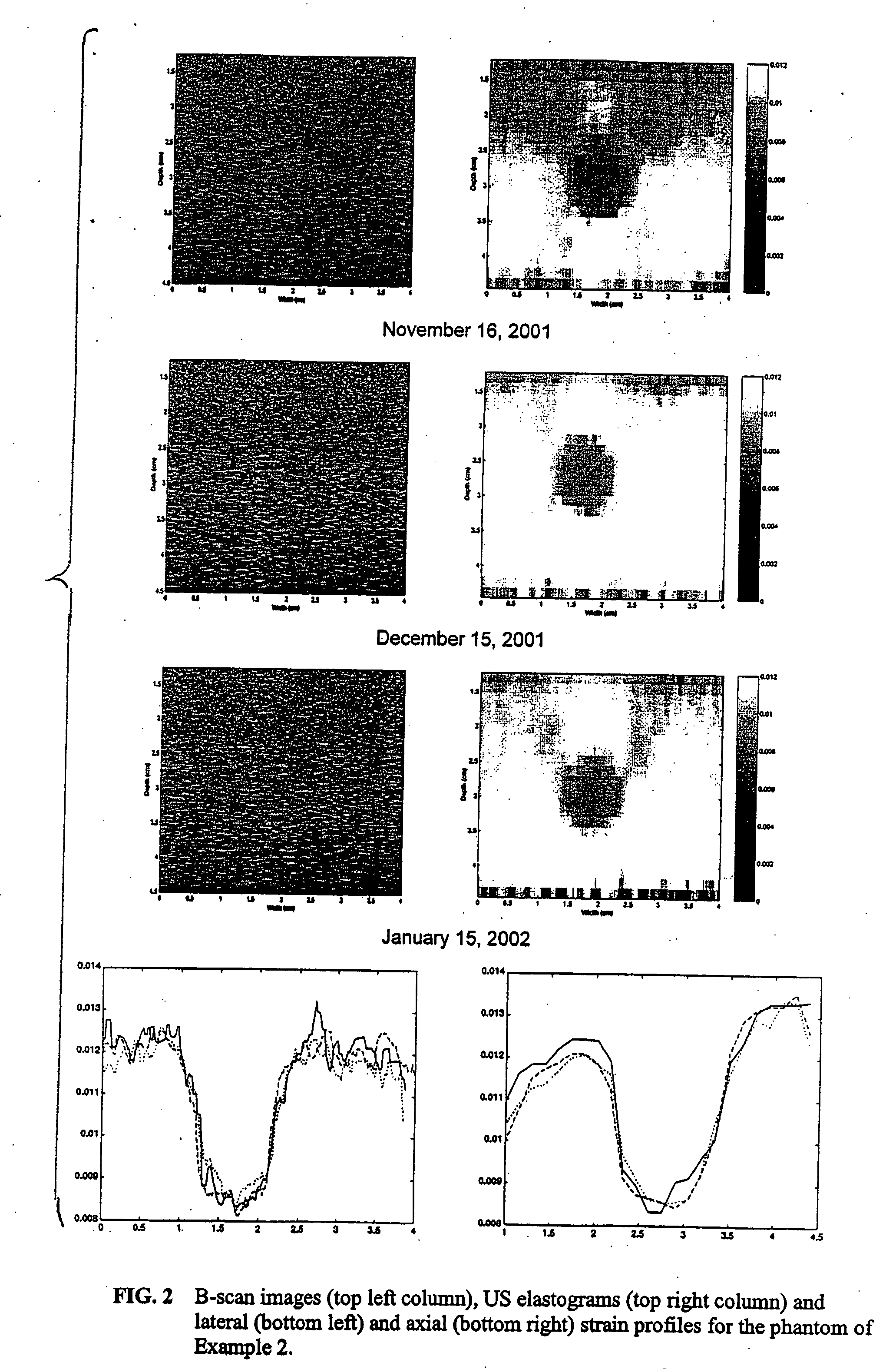 Tissue mimicking elastography phantoms