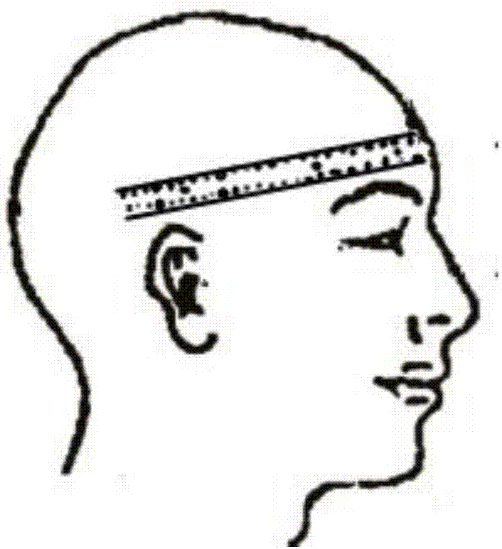 Novel intracranial lesion scalp locating ruler sticker