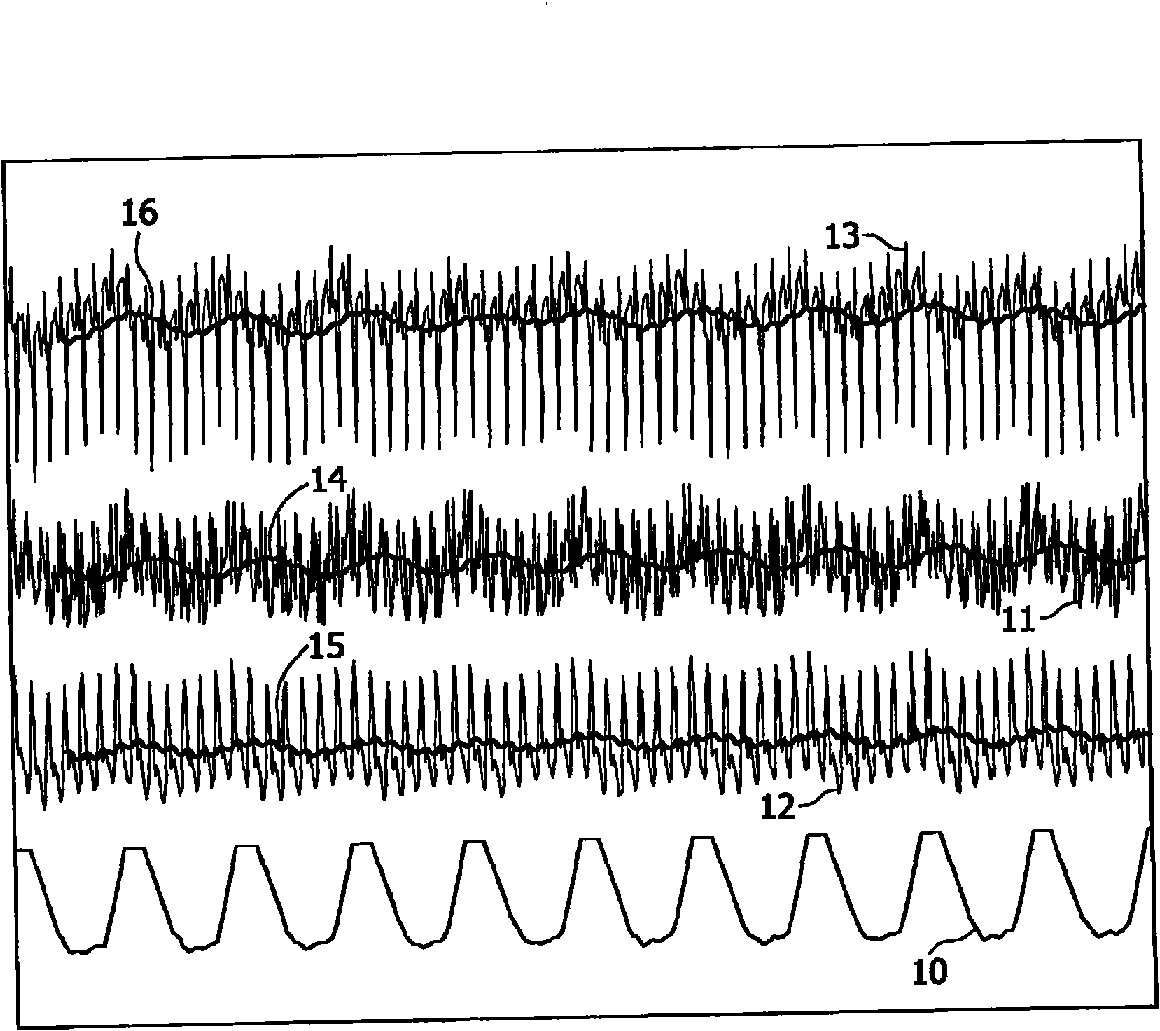 Patient monitoring system and method