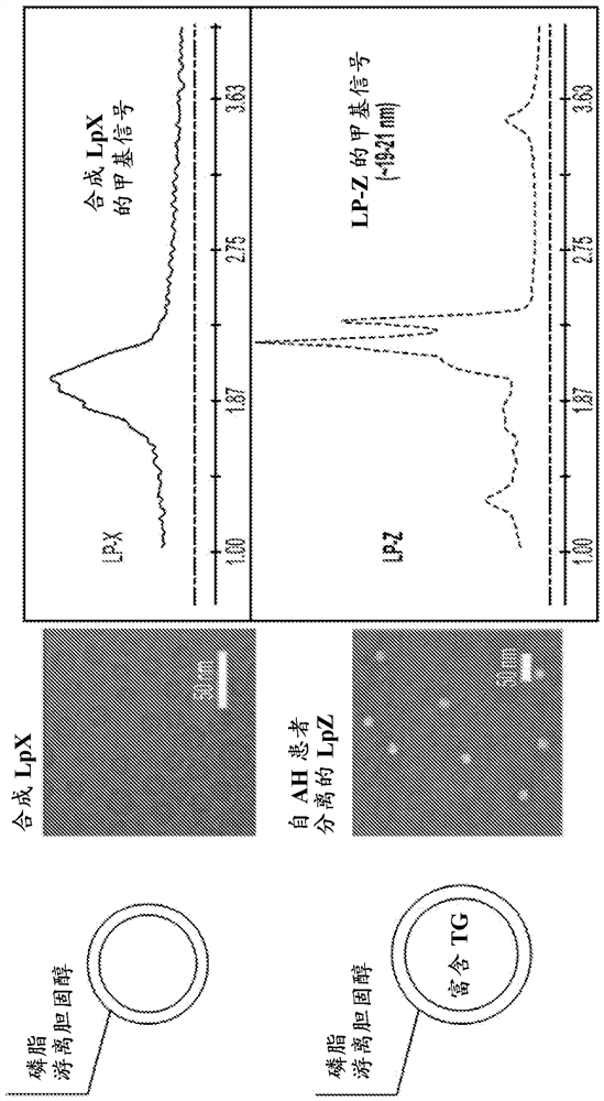 Methods to predict liver disease mortality using lipoprotein lp-z