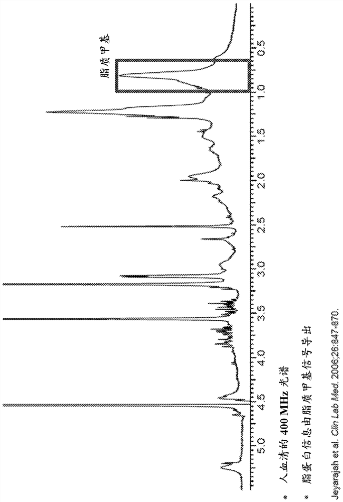 Methods to predict liver disease mortality using lipoprotein lp-z