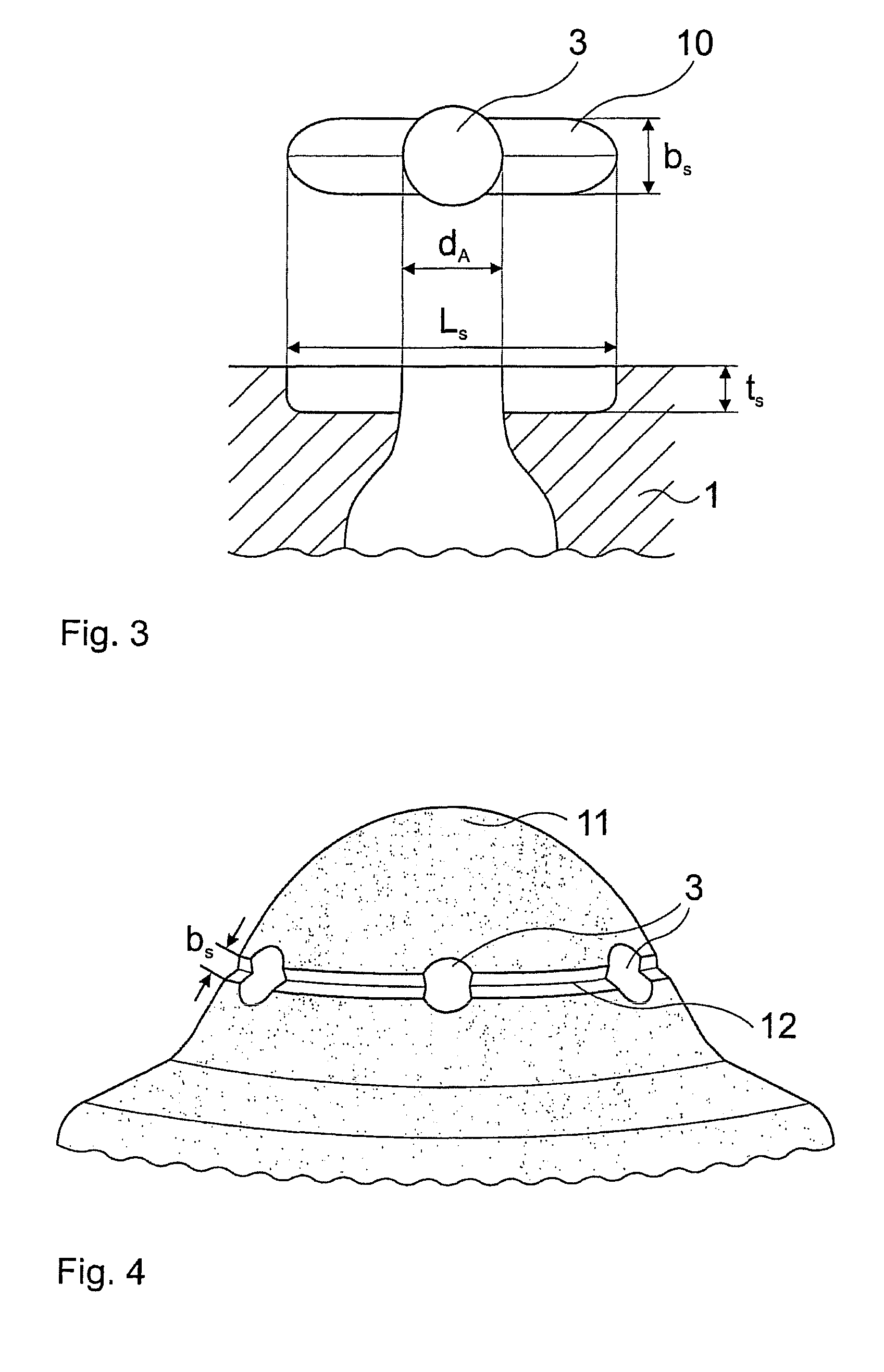 Method for boring bottle-like holes having a defined geometry by means of pulsed laser radiation