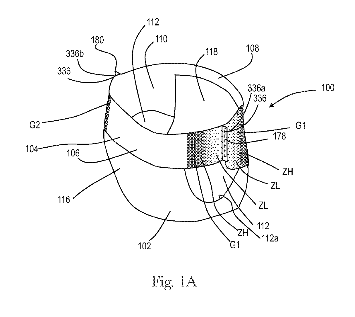 Apparatuses and methods for making absorbent articles with low intensity side seam regions