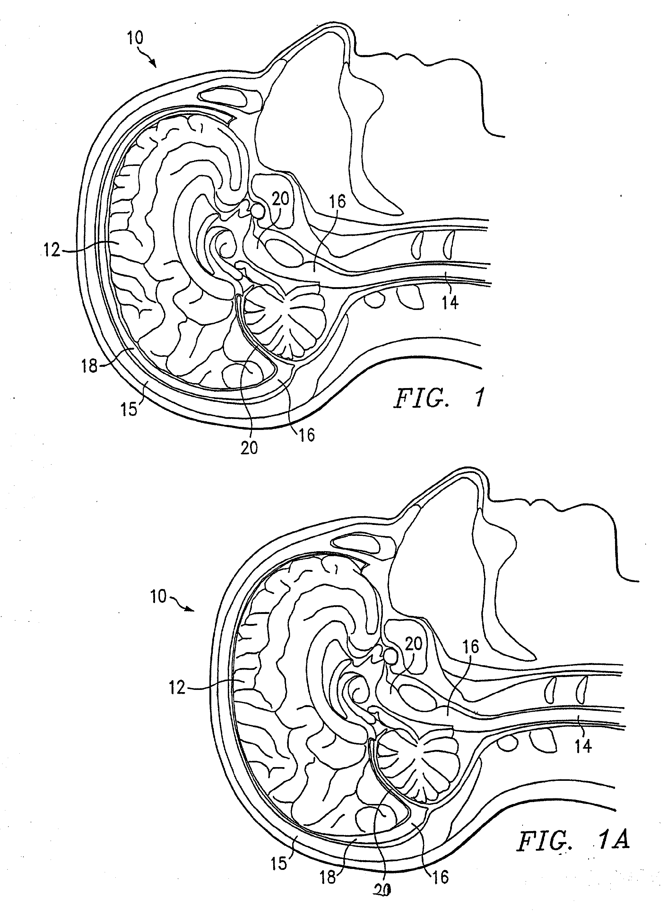 Therapeutic Cooling Devices