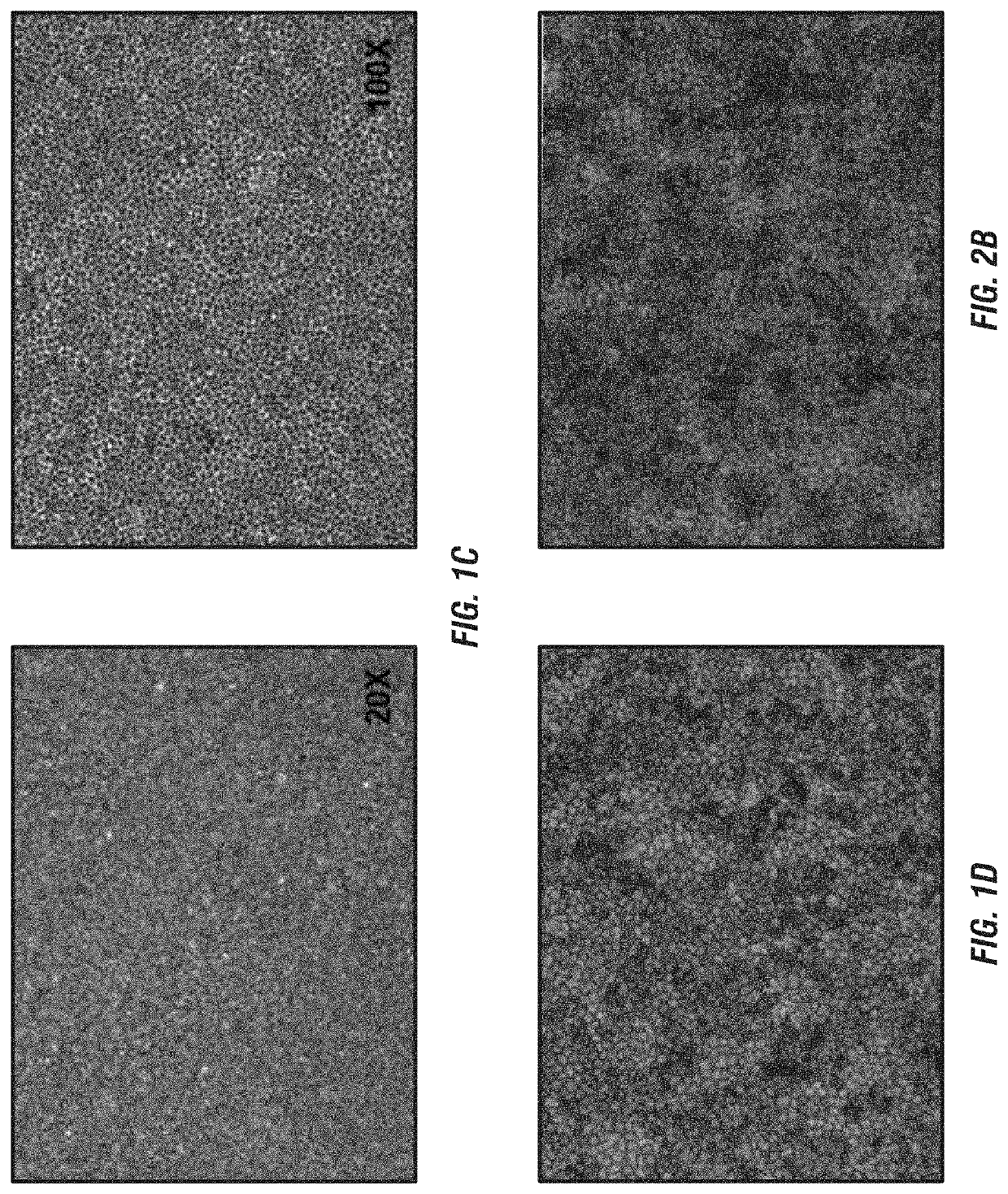 Macs-based purification of stem cell-derived retinal pigment epithelium