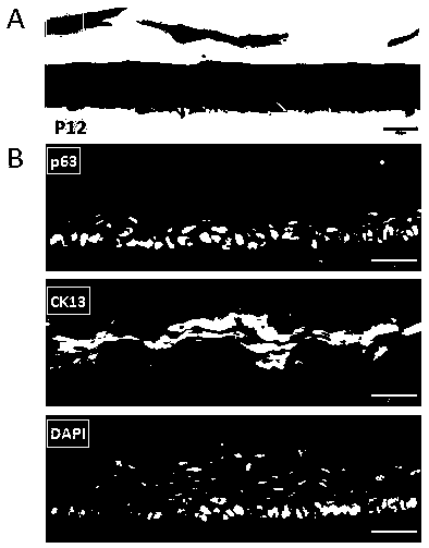 A method for isolating and culturing esophageal epithelial stem cells