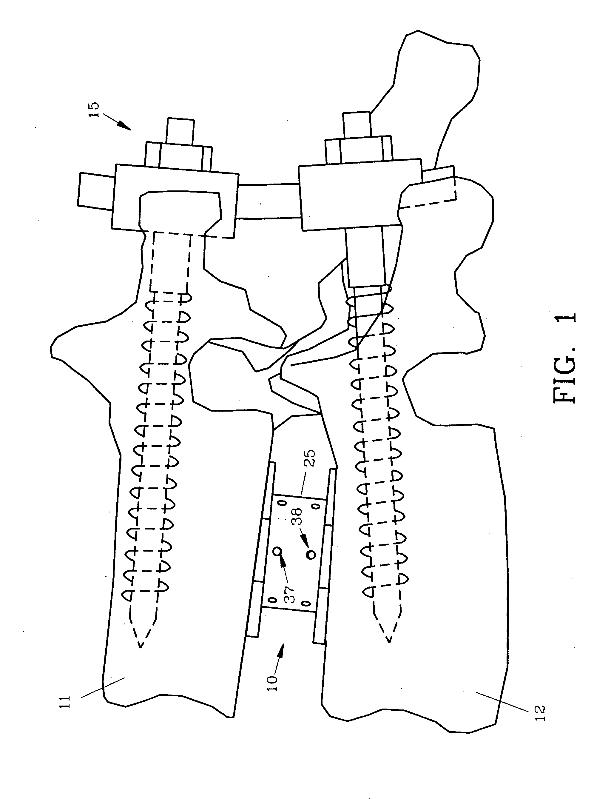 Spinal interbody fusion device and method