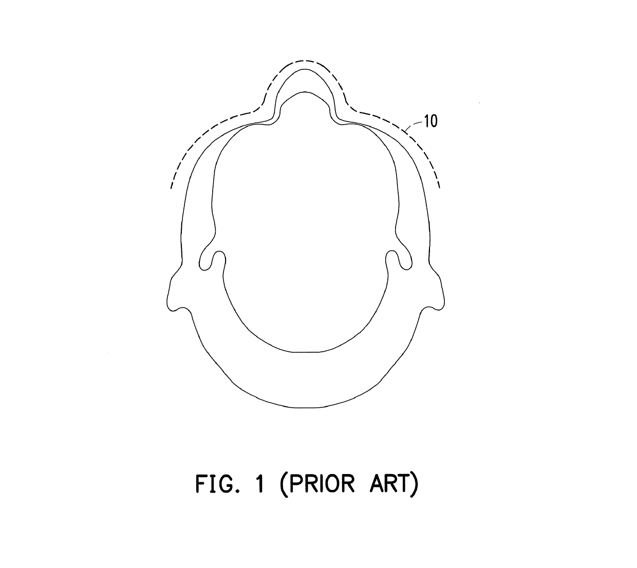 Head-mounted display device