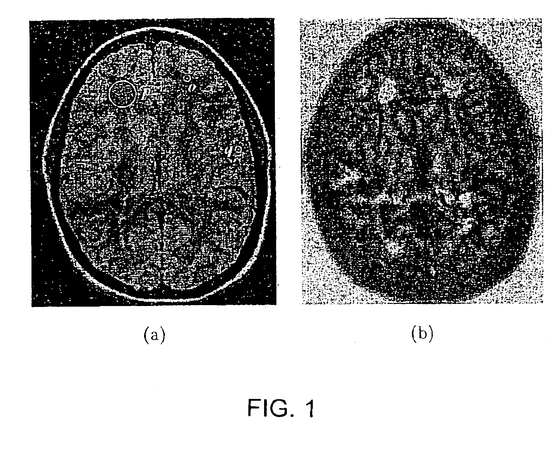 Scale-based image filtering of magnetic resonance data