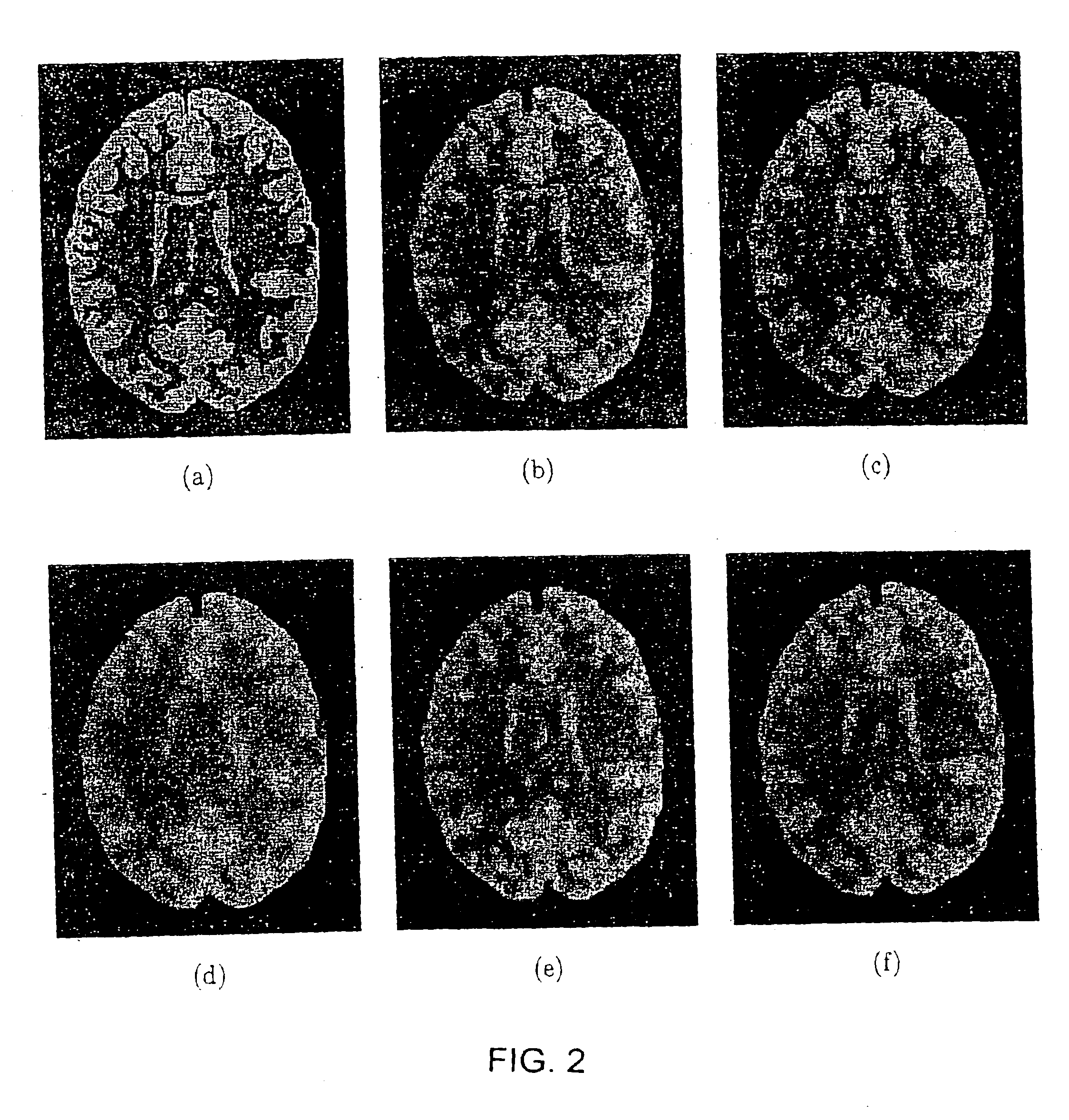 Scale-based image filtering of magnetic resonance data