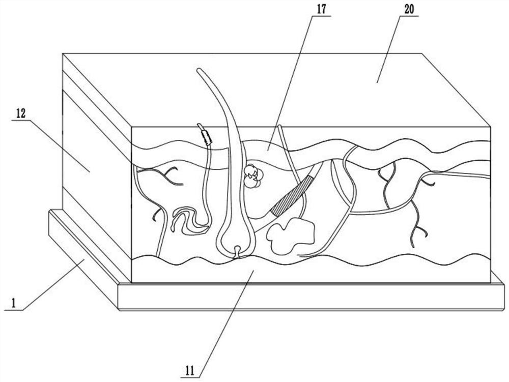 In-vitro skin model for researching hidradenitis suppurativa and preparation method thereof