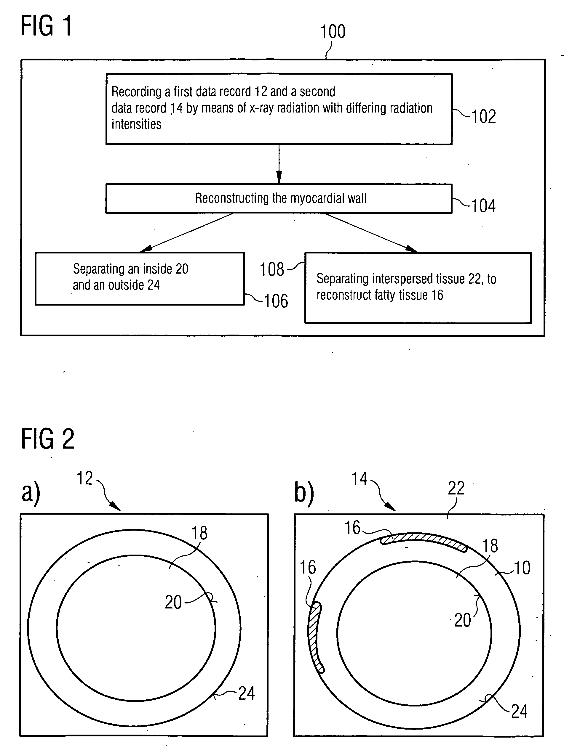 Method for segmenting a myocardial wall and device for detecting a coronary artery with pathological changes