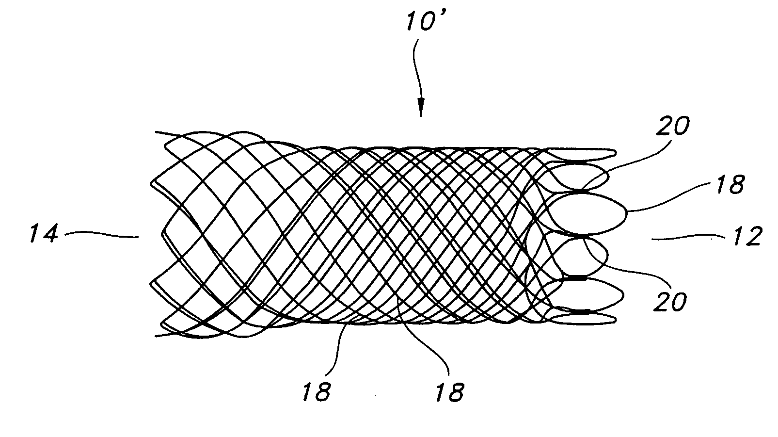 Method for reducing stent weld profiles and a stent having reduced weld
