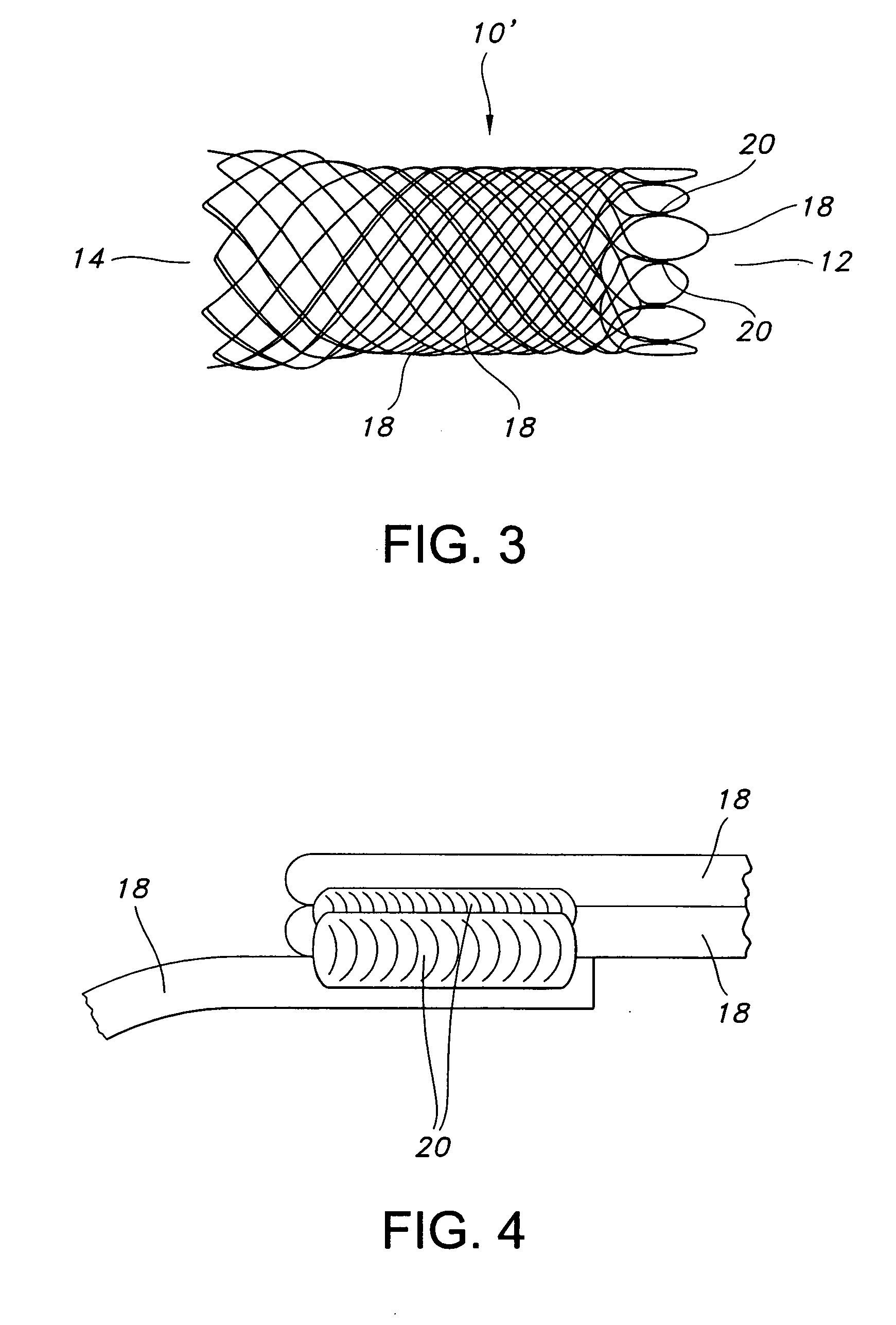 Method for reducing stent weld profiles and a stent having reduced weld