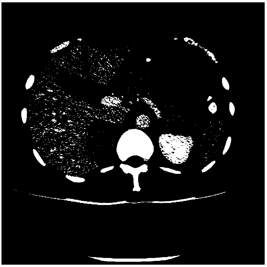 Abdomen CT (Computed Tomography) image multi-organ segmentation method based on superpixel