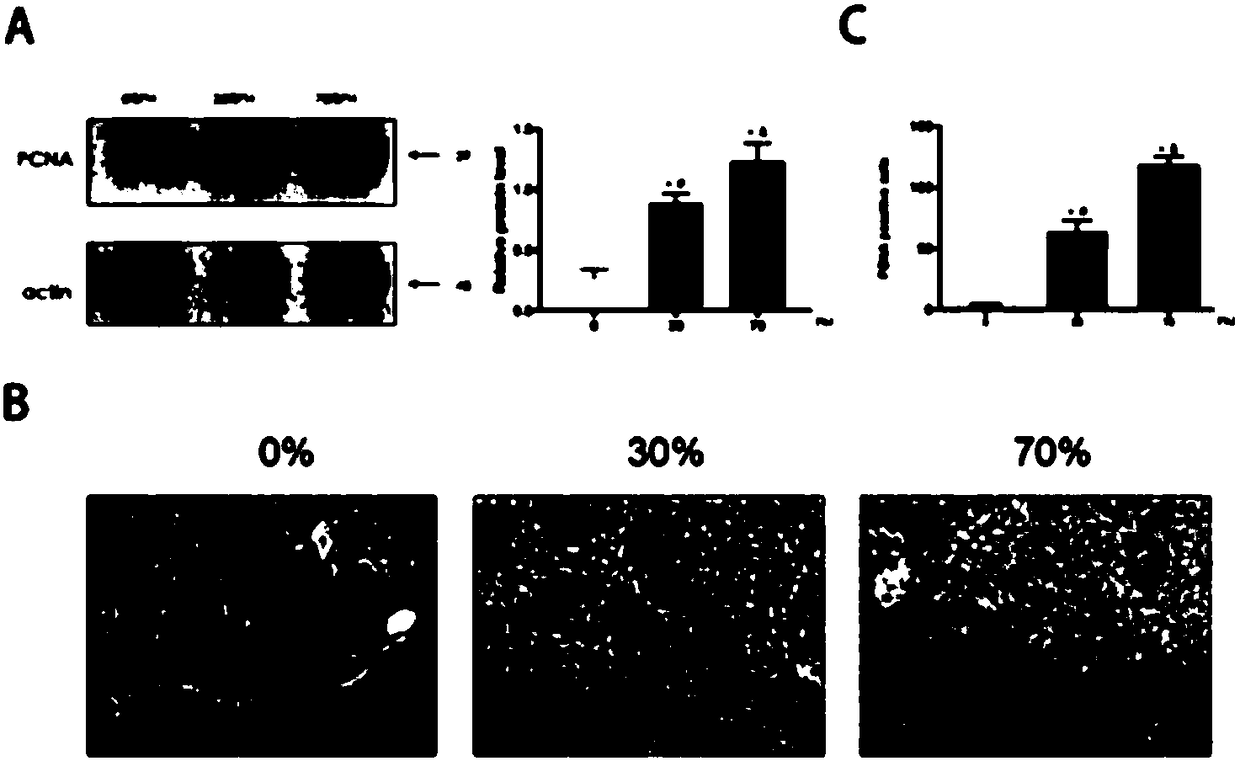 Method for promoting growth of mice liver implanted tumor after partial hepatectomy