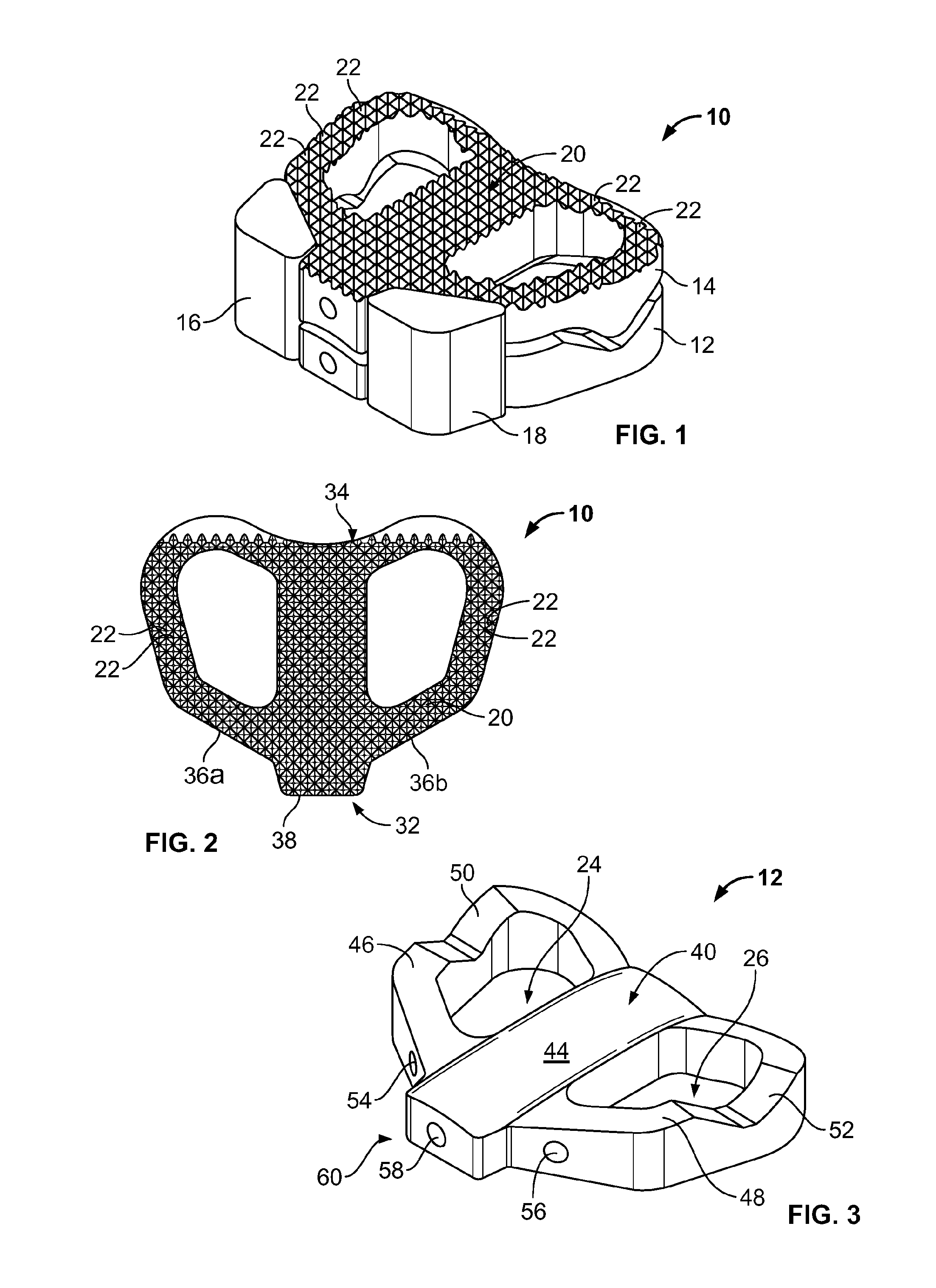 Spinal implant, instrument for preparation and method of use