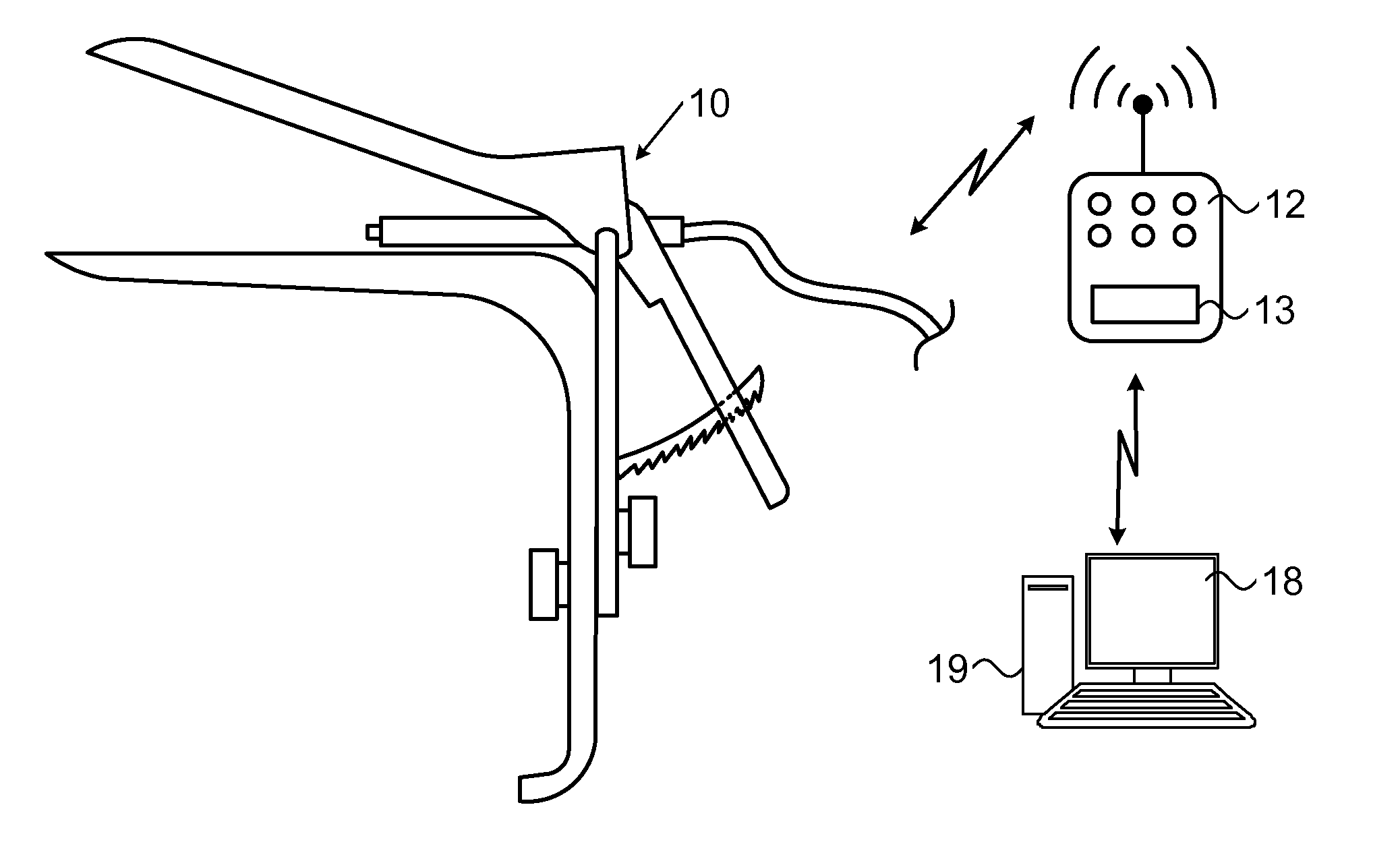 System, device and method for gynecological use