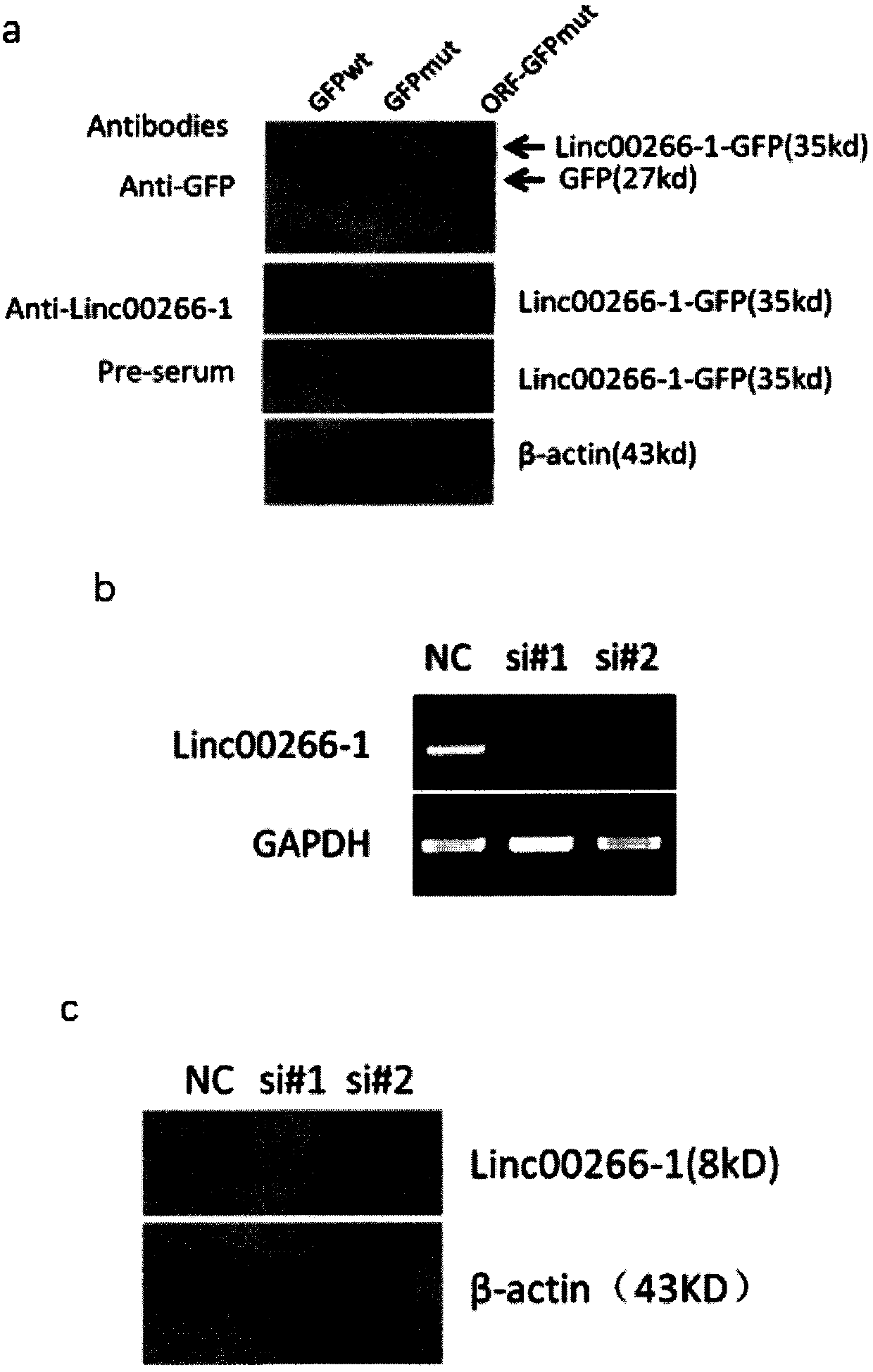 Application of LINC00266-1 polypeptide as solid tumor marker